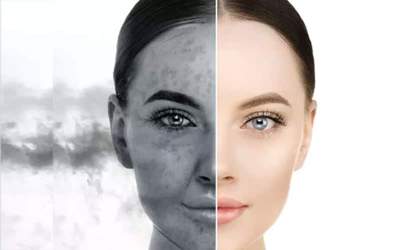 مراقبت از پوست هنگام هوای آلوده