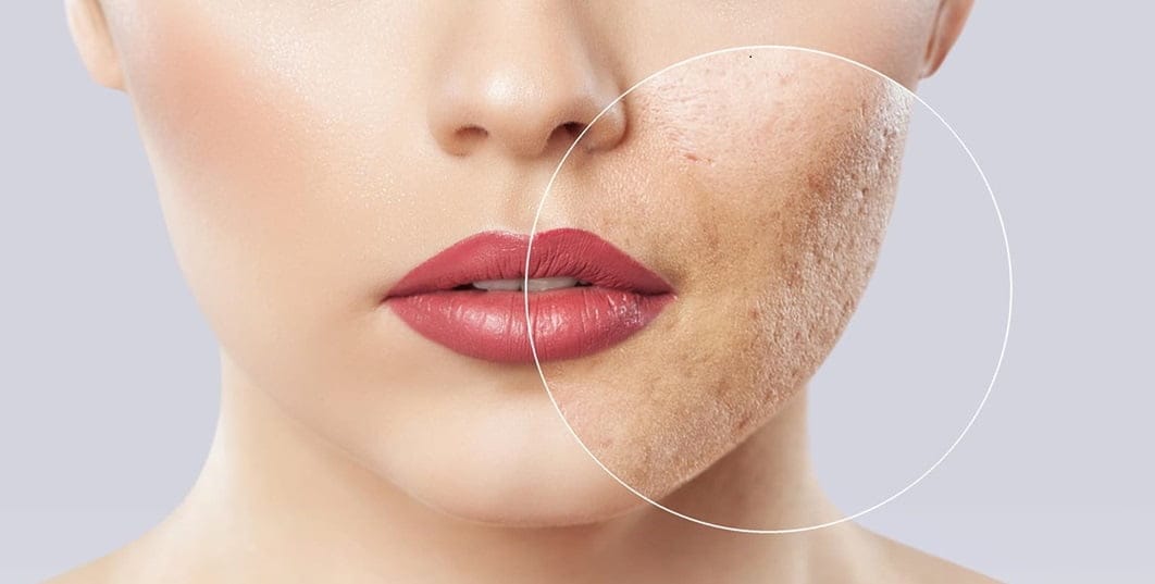 معرفی کرم های ترمیم کننده زخم؛ انواع کرم برای از بین بردن جای زخم کرم های ترمیم کننده زخم