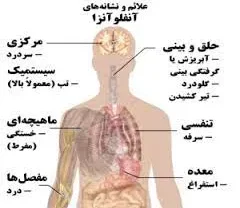 آنفولانزای شدید آنفولانزای شدید