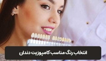 طبیعی ترین و بهترین رنگ کامپوزیت دندان کدام است؟ طبیعی ترین و بهترین رنگ کامپوزیت دندان کدام است؟