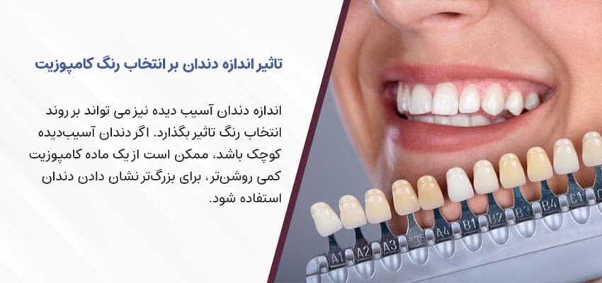 طبیعی ترین و بهترین رنگ کامپوزیت دندان کدام است؟