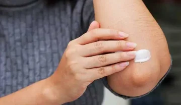 سفید کردن آرنج؛ دلایل تیره شدن آرنج و 17 روش سفید کردن این ناحیه سفید کردن آرنج