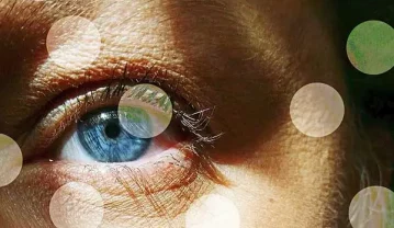 مگس پرانی چشم چیست؟ دلایل ایجاد نقاط متحرک در چشم و روش های درمان مگس پرانی چشم