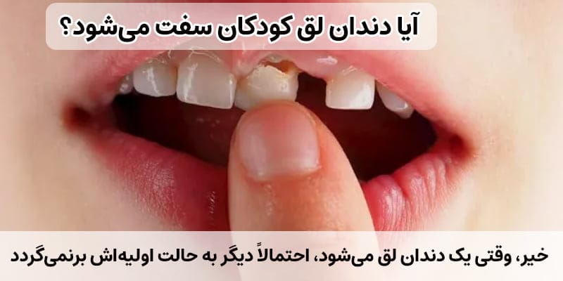 لق شدن دندان شیری کودک 2 عوامل لق شدن دندان