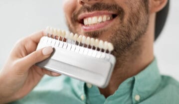 فرق لمینت و کامپوزیت چیست؟