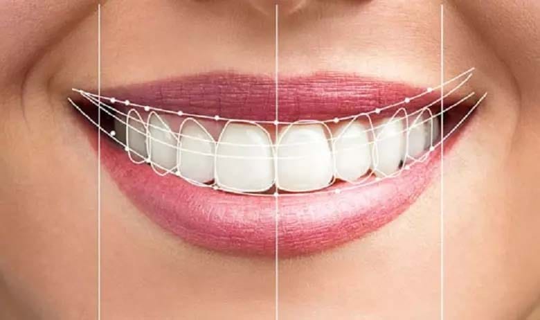 تفاوت لمینت و کامپوزیت؛ مقایسه ویژگی ها و نحوه انجام 5 the difference between laminate and composite 2