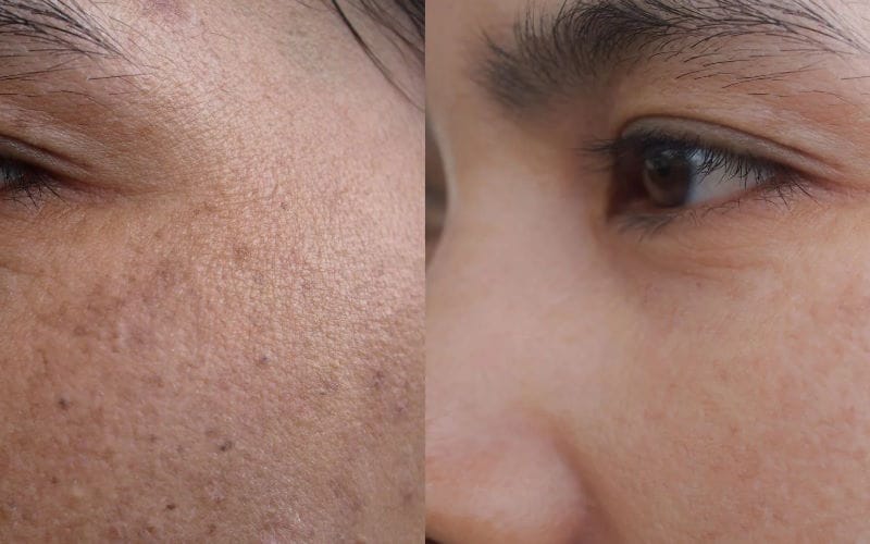 روش های طبیعی برای روشن تر کردن پوست