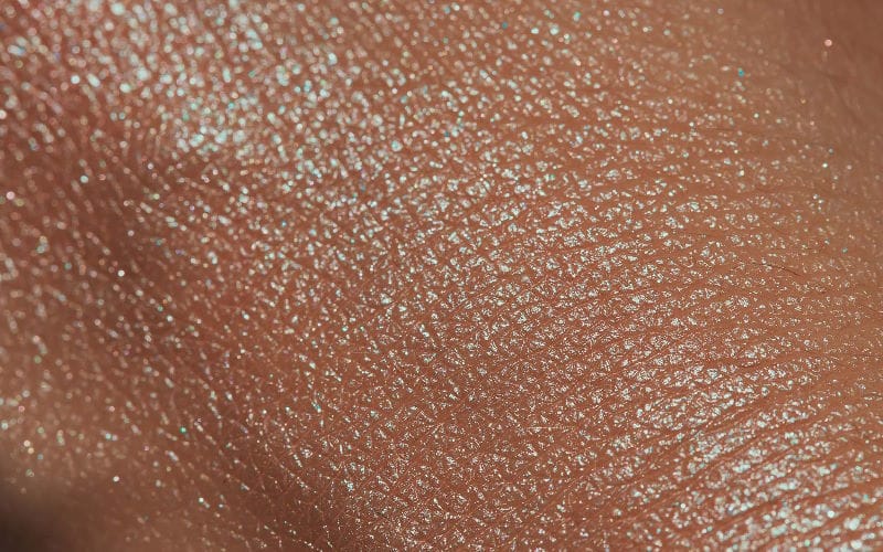 چگونه خشکی پوست به مشکلات جدی تری منجر می شود؟ 