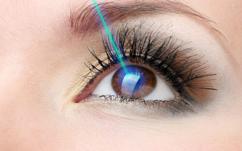 LASIK