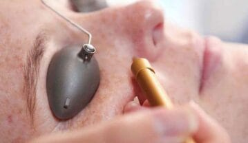 پاره شدن مویرگ زیر چشم {علت و علائم و روش های درمان} پاره شدن مویرگ زیر چشم {علت و علائم و روش های درمان}