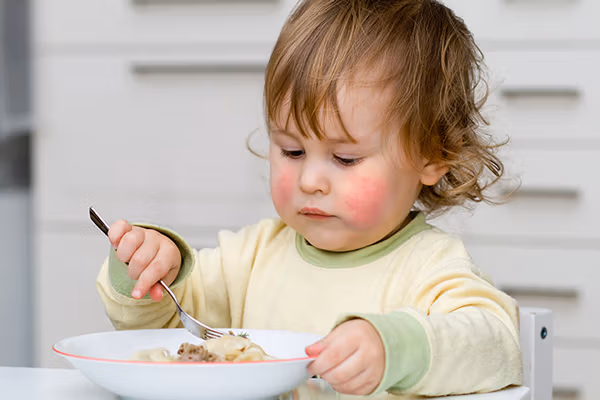 آلرژی غذایی کودکان؛ روش های تشخیص، علائم و مدیریت آلرژی نوزاد و کودک 4 آلرژی غذایی کودکان؛ روش های تشخیص، علائم و مدیریت آلرژی نوزاد و کودک