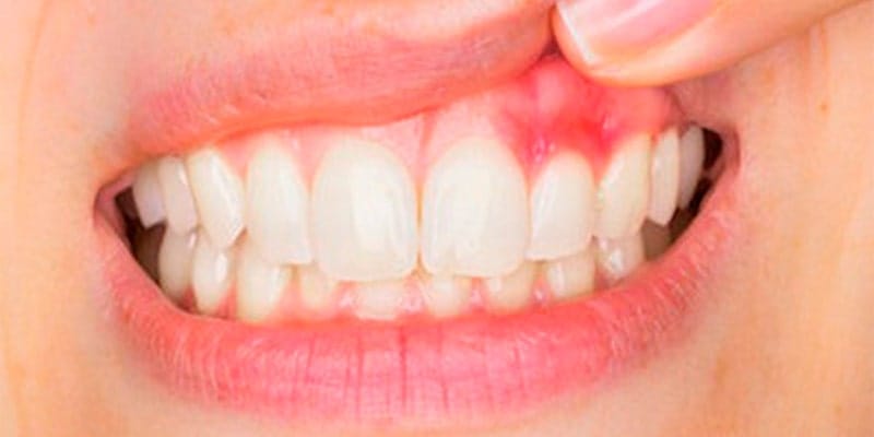 فواید خیار دریایی و نکات مهم مصرف آن (از پیشگیری از سرطان تا درمان بیماری های لثه) 6 فواید خیار دریایی و نکات مهم مصرف آن (از پیشگیری از سرطان تا درمان بیماری های لثه)