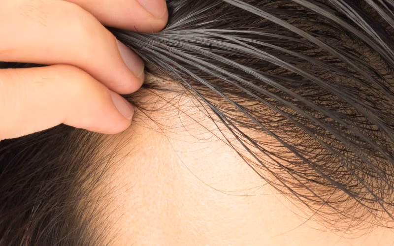 شستشوی موهای چرب و مراقبت اصولی؛ نکات تخصصی 2 از بین بردن چربی مو بدون شستشو ممکن است؟