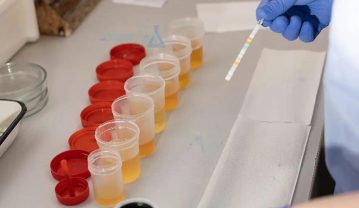 آزمایش ادرار (Urinalysis) چه چیزهایی را بررسی می کند؟