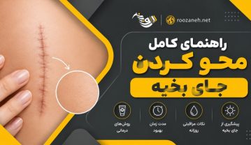 محو کردن جای بخیه