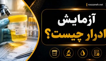 آزمایش ادرار