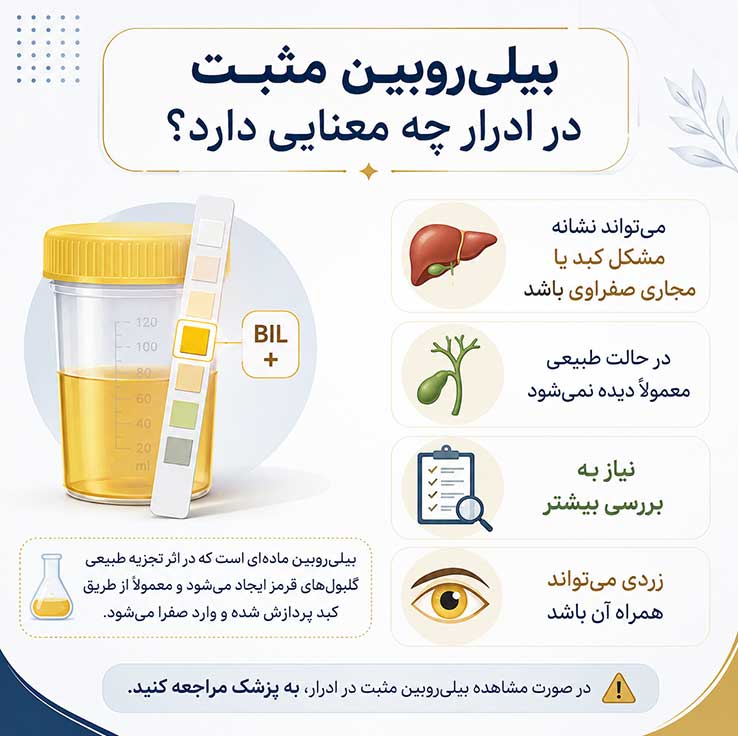 بیلی‌روبین مثبت در ادرار چه معنایی دارد؟