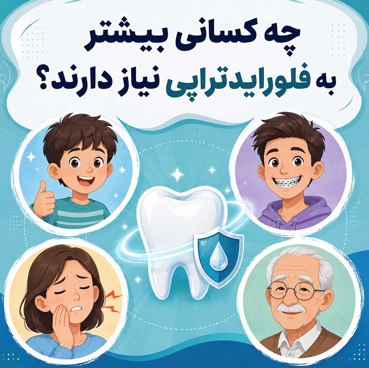 فلورایدتراپی چیست؟ فواید، عوارض، مراحل انجام و مراقبتهای بعد از آن 3 چه کسانی بیشتر به فلورایدتراپی نیاز دارند؟