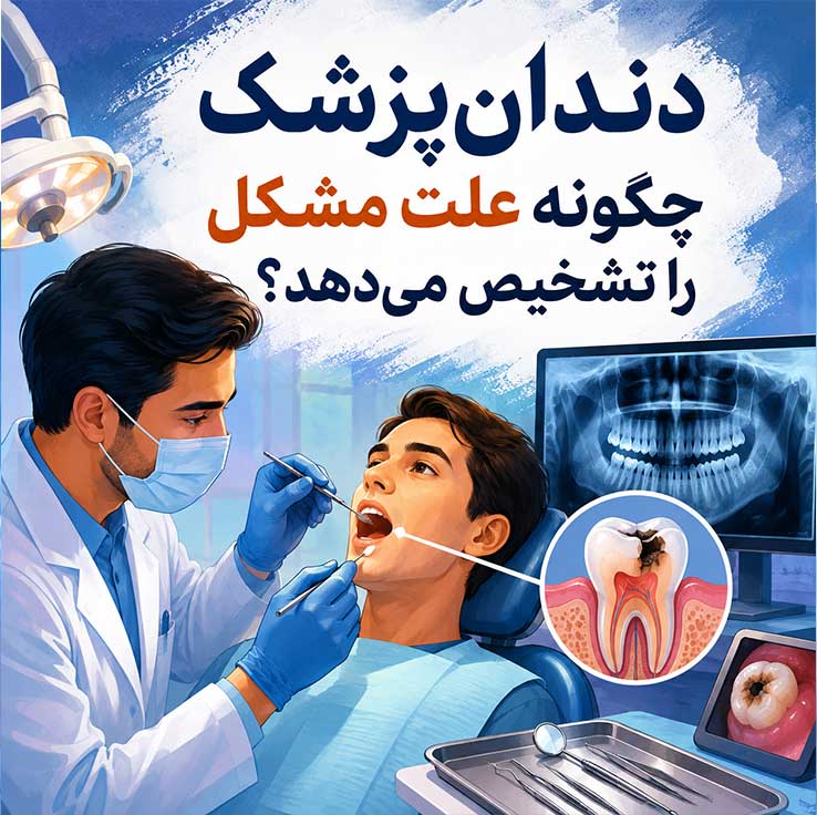 خوردگی مینای دندان در زیر لثه؛ علت، علائم، درمان و راههای پیشگیری 4 دندانپزشک چگونه علت مشکل را تشخیص میدهد؟