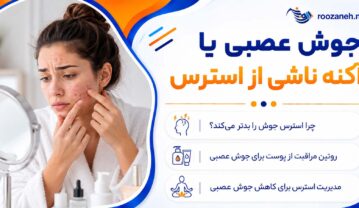 جوش عصبی
