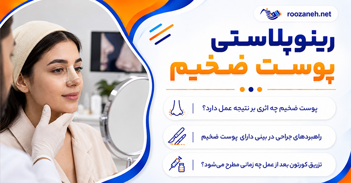 رینوپلاستی پوست ضخیم؛ نتیجه عمل بینی گوشتی و مدت ماندگاری ورم؛ مراقبتها و انتظارات واقعبینانه 1 رینوپلاستی پوست ضخیم؛ نتیجه عمل بینی گوشتی و مدت ماندگاری ورم؛ مراقبتها و انتظارات واقعبینانه