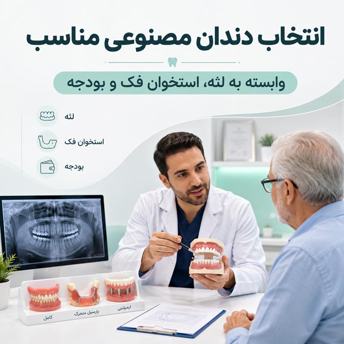 انواع دندان مصنوعی؛ راهنمای کامل انتخاب، نصب و هزینهها 1 نمونه انواع دندان مصنوعی و پروتزهای دندانی