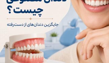 دندان مصنوعی