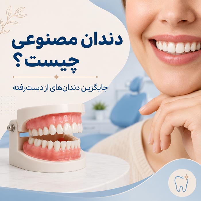 انواع دندان مصنوعی؛ راهنمای کامل انتخاب، نصب و هزینهها 3 دندان مصنوعی پارسیل برای جایگزینی چند دندان