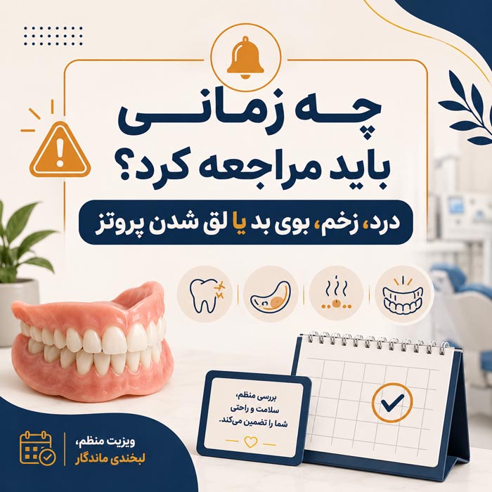 انواع دندان مصنوعی؛ راهنمای کامل انتخاب، نصب و هزینهها 4 اوردنچر و دندان مصنوعی متکی بر ایمپلنت