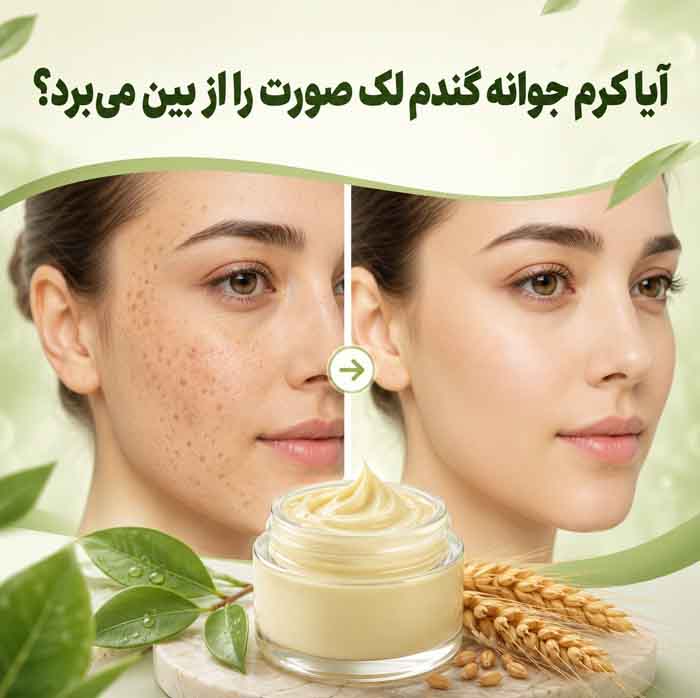 کرم جوانه گندم برای پوست؛ فواید احتمالی برای خشکی و خطوط ریز؛ واقعیت تأثیر آن بر لک چیست؟ 4 آیا کرم جوانه گندم لک صورت را از بین میبرد؟