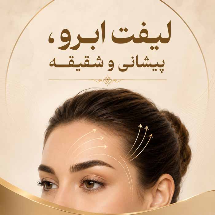 انواع جراحی زیبایی صورت و بدن؛ معرفی ۳۲ عمل رایج؛ کاربردها، عوارض و مراقبتهای دوره نقاهت 4 ۵. لیفت ابرو، پیشانی و شقیقه