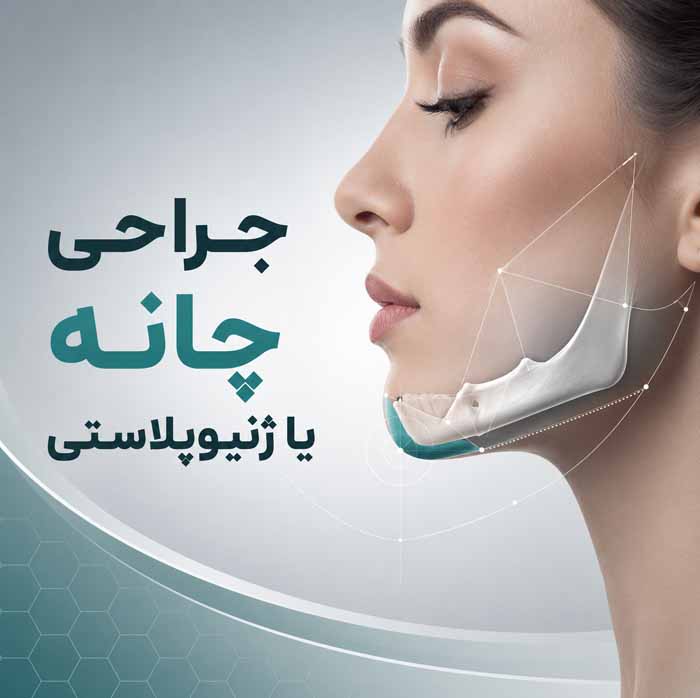 انواع جراحی زیبایی صورت و بدن؛ معرفی ۳۲ عمل رایج؛ کاربردها، عوارض و مراقبتهای دوره نقاهت 5 ۹. جراحی چانه یا ژنیوپلاستی