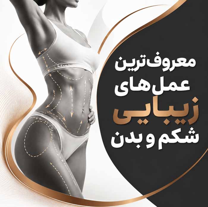انواع جراحی زیبایی صورت و بدن؛ معرفی ۳۲ عمل رایج؛ کاربردها، عوارض و مراقبتهای دوره نقاهت 8 معروفترین عملهای زیبایی شکم و بدن