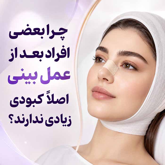 رفع کبودی بینی و دور چشم بعد از عمل زیبایی بینی؛ مراقبتها، زمان بهبود و نکات مهم 5 چرا بعضی افراد بعد از عمل بینی اصلاً کبودی زیادی ندارند؟