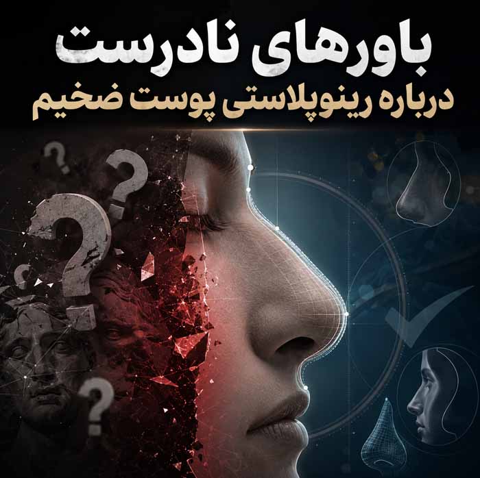 رینوپلاستی پوست ضخیم؛ نتیجه عمل بینی گوشتی و مدت ماندگاری ورم؛ مراقبتها و انتظارات واقعبینانه 6 باورهای نادرست درباره رینوپلاستی پوست ضخیم