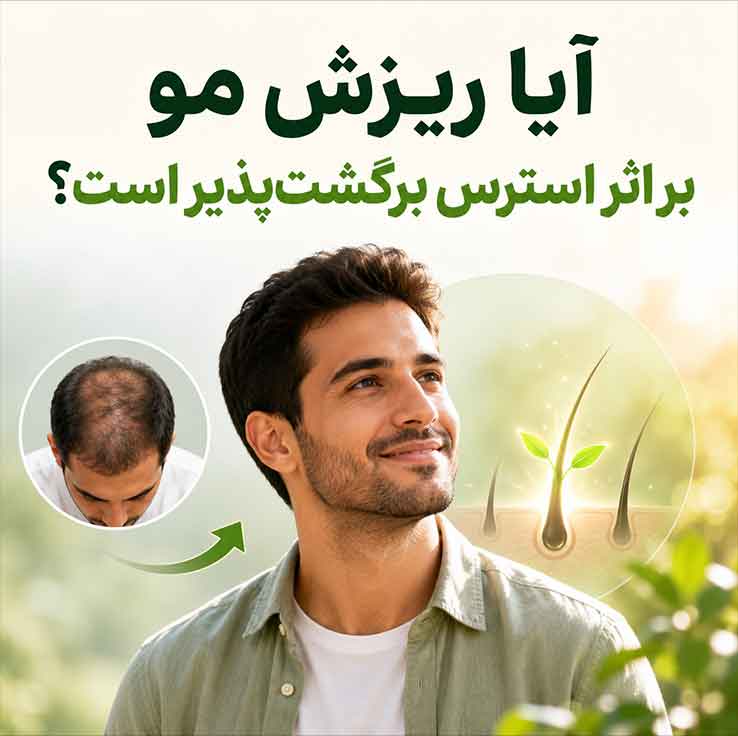 آیا ریزش مو بر اثر استرس برگشت‌پذیر است؟