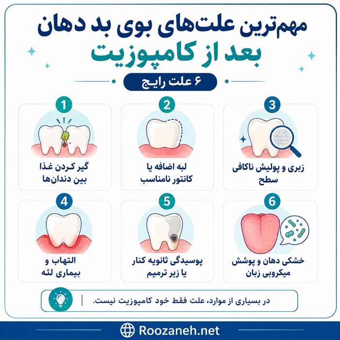 تمیز کردن و پولیش کامپوزیت دندان