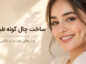 چال گونه طبیعی