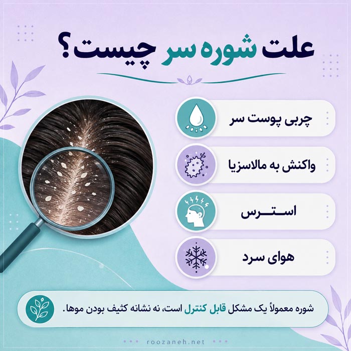 تفاوت شوره سر و پوسته سر؛ از تشخیص تا درمان درست هرکدام 4 علت شوره سر شامل چربی پوست مالاسزیا استرس و هوای سرد