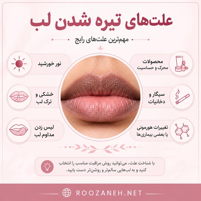 ۷ روش خانگی برای روشن شدن لبهای تیره؛ راهنمای کامل و ایمن 5 دلایل لب تیره