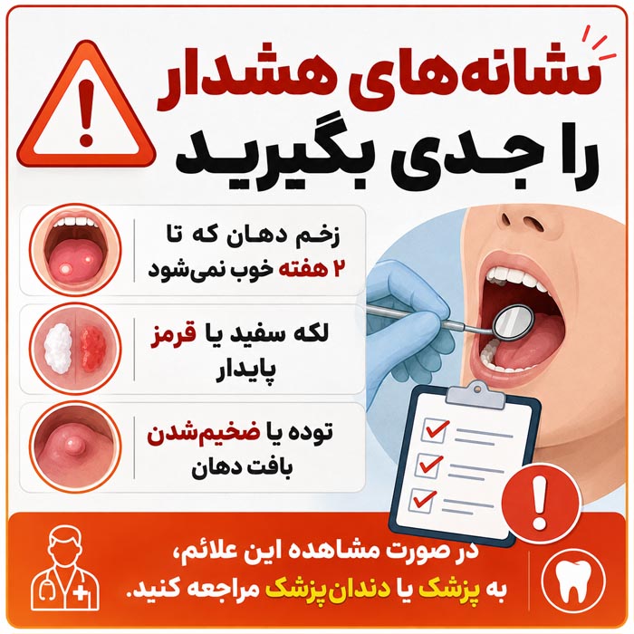 نشانه‌های هشدار عوارض ناس در دهان و زمان مراجعه به پزشک