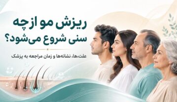 ریزش مو از چه سنی شروع میشود؟ علت، علائم و درمان کمپشتی مو ریزش مو از چه سنی شروع میشود؟ علت، علائم و درمان کمپشتی مو