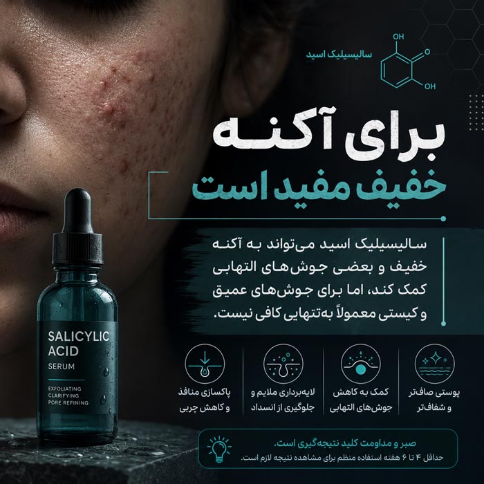 سرم سالیسیلیک اسید برای چی خوبه؟ راهنمای کامل استفاده و عوارض 2 سرم سالیسیلیک اسید برای پوست چرب و جوشدار