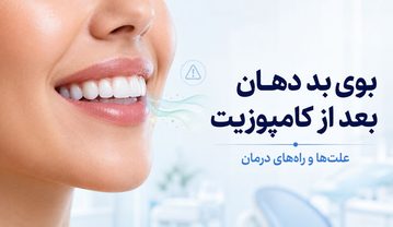 بوی بد دهان بعد از کامپوزیت؛ علتها، درمان و زمان تعویض کامپوزیت بوی بد دهان بعد از کامپوزیت