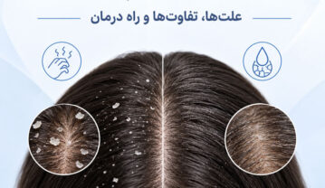 تفاوت شوره سر و پوسته سر