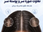 تفاوت شوره سر و پوسته سر؛ از تشخیص تا درمان درست هرکدام تفاوت شوره سر و پوسته سر