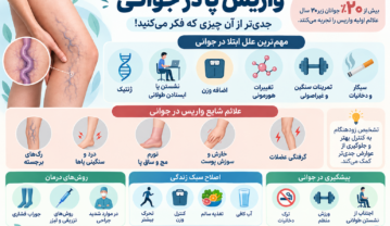 چرا یک جوان 25 ساله واریس پا می گیرد؟