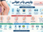 چرا یک جوان 25 ساله واریس پا می گیرد؟ چرا یک جوان 25 ساله واریس پا می گیرد؟