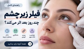 فیلر زیر چشم چند روز بعد اثر می‌کند