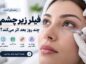 فیلر زیر چشم چند روز بعد اثر می‌کند